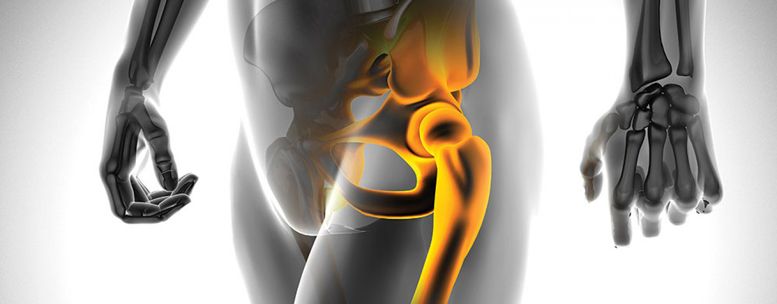 ισχίο χειρουργείο