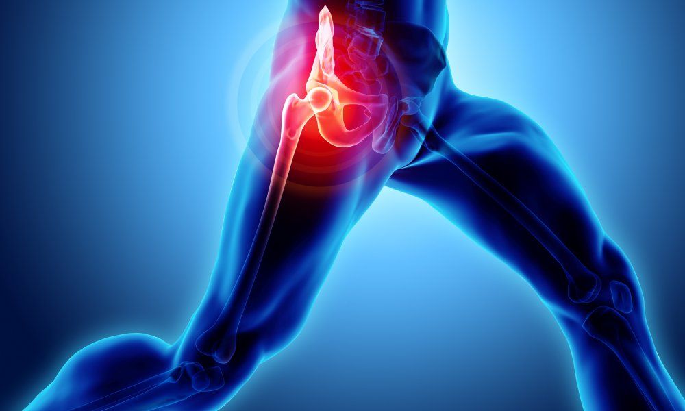 ισχίο χειρουργείο